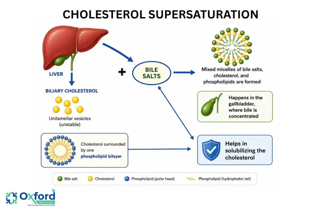 What are the Symptoms of Gallbladder Stones