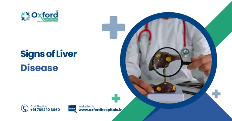Signs of Liver Disease