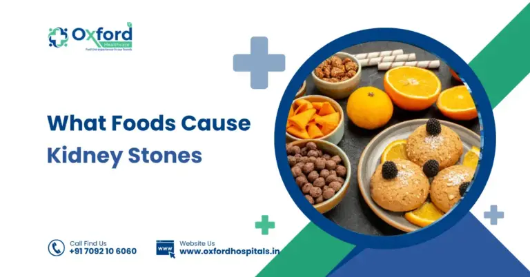 What Foods Cause Kidney Stones