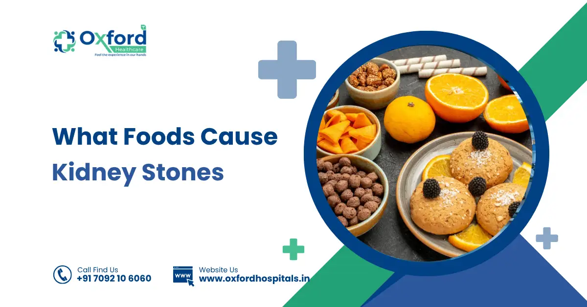 What Foods Cause Kidney Stones
